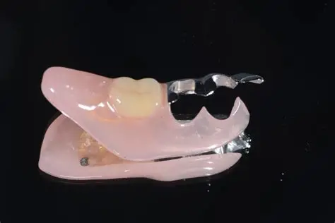 1歯欠損用の部分入れ歯(クラスプ付き)