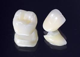 ジルコニアクラウン